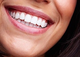 Close up of smile with healthy teeth and gums