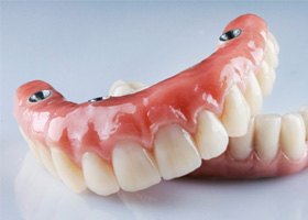 two removable implant dentures