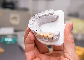 Model with dental bridge 