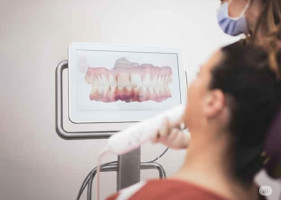 Dental assistant using iTero Lumina Scanner