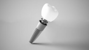 digital rendering of a dental implant and crown 